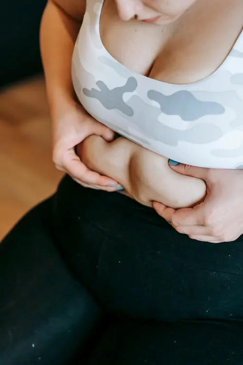  A woman holding abdominal fat highlights obesity and weight management with tirzepatide treatment.