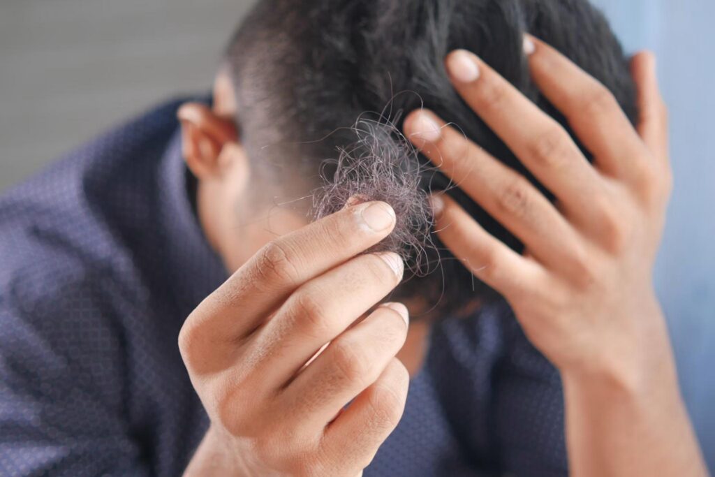 person holding shed hair while examining thinning hair and early hair loss symptoms