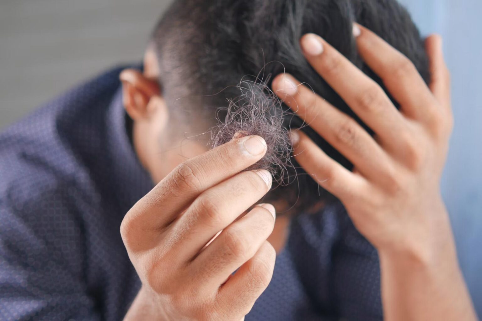 person holding shed hair while examining thinning hair and early hair loss symptoms