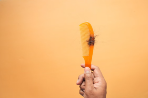 hair collected on a comb representing ongoing hair loss and a plateau in hair loss treatment results