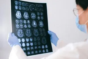 How Does Ketamine Work in the Brain?